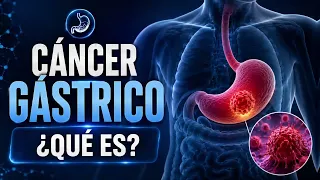 Cáncer Gástrico: El Papel de la Nutrición Durante el Tratamiento