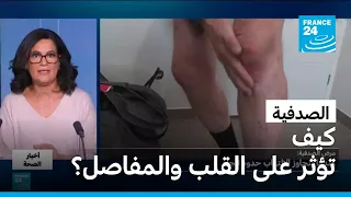 الصدفية.. كيف تؤثر على القلب والمفاصل؟ • فرانس 24 / FRANCE 24