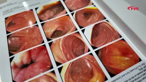 ЦЭЭЖ ХОРСОЛТ, ЭЛЭГНИЙ ӨӨХЛӨЛТ ЗЭРЭГ ОЛОН ЭМГЭГИЙГ ИЛРҮҮЛЭХЭД ХАМГИЙН СҮҮЛИЙН АППАРАТ АШИГЛАЖ БАЙНА