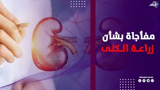 مفاجأة.. حسام موافي يكشف إمكانية إعادة زراعة الكلى بعد فشل الجراحة الأولى