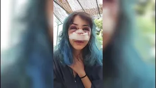 Giuditta d'Elia: "They broke my nose, but I found community in your messages of support"