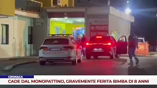 SCOOTER Service