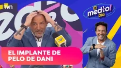 Did Dani Fuenzalida's hair transplant work?