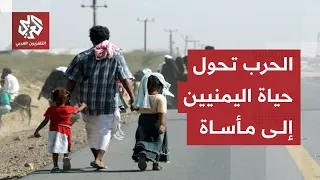 Amidst Raging Battles on Various Fronts.. What Is the Humanitarian Situation in Yemen?
