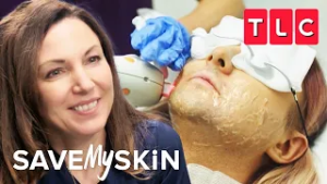 Hairy Situations | Save My Skin | TLC