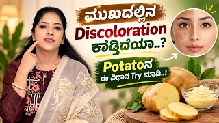 ಮುಖದಲ್ಲಿನ Discoloration ಕಾಡ್ತಿದೆಯಾ..? Potatoನ ಈ ವಿಧಾನ Try ಮಾಡಿ..! | Beauty Tips | Ayush TV