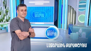 Եղիր առողջ. լազերային քարափշրում