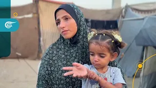 "Even her clothes cause her pain".. Epidermolysis bullosa ravages the body of a girl from Gaza