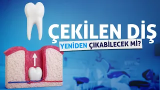 New drug developed by Japanese scientists raises hope that missing teeth can grow back