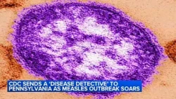 CDC sends disease detective to Pennsylvania as measles outbreak soars