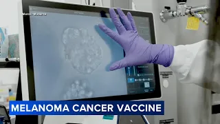New breakthrough in melanoma vaccine