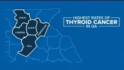 Unusually high thyroid cancer rates in northeast Georgia sparks new research