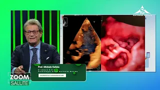Zoom Health - Prof. Michele Gulizia - Director of the Cardiology Unit at ARNAS Garibaldi Nesima
