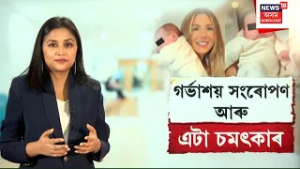 'Simply A Miracle' | মৃত মহিলাৰ গৰ্ভাশয়ে বিট্ৰিছ দম্পতীৰ কোলাত তুলি দিলে সন্তান |  N18G