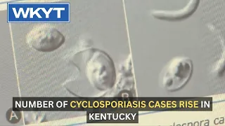 Number of cyclosporiasis cases rise in Kentucky