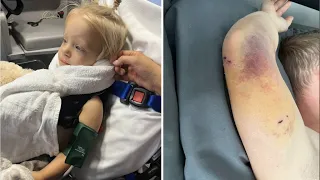 Castle Rock family still reeling 2 years after police K-9 attack on toddler