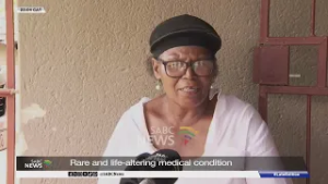 Rare and life-altering medical condition