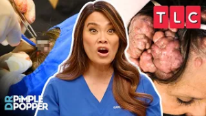 Every. Single. Pop. EVER! | Dr. Pimple Popper | TLC