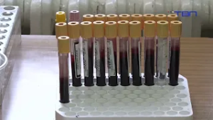 Trista pacijenata dnevno uradi laboratorijske analize - TV Pančevo