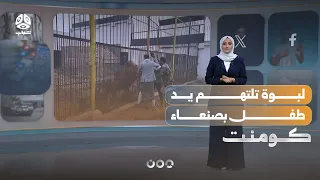 Lioness attacks Yemeni child and severs his hand | Comment