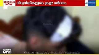 കണ്ണൂരിൽ പ്ലസ് വൺ വിദ്യാർത്ഥിക്ക് സീനിയർ വിദ്യാർത്ഥികളുടെ ക്രൂര മർദ്ദനം