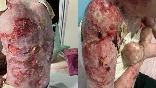 Tirense with rare disease asks for help to continue treatment