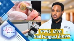 የጥፍር ፈንገስ (Nail Fungus) ሕክምና //New Life//
