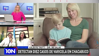 CELESTE TROTTI REPORT: TEN CASES OF CHICKENPOX DETECTED IN CHACABUCO