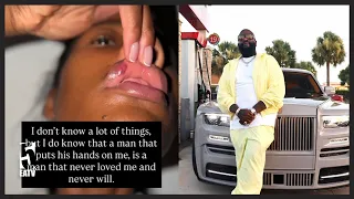 WOMAN BEATEN BY RICK ROSS TELLS ALL ON THE CAUSE OF THEIR CONFLICT-eNewz