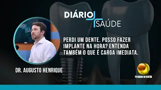 Perdi um dente. Posso fazer implante na hora? Entenda também o que é a carga imediata