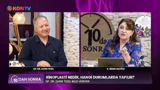 AFTER 10:00 AM JULY 29, 2026 OP. DR. ZAFER TEZEL