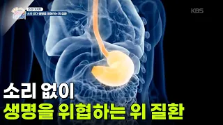 [건강 아지트] 소리 없이 생명을 위협하는 위 질환 [생방송 굿모닝 대한민국] | KBS 260923 방송