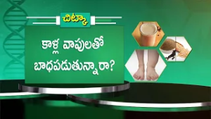 కాళ్ల వాపులతో బాధపడుతున్నారా? | Health Tip For Foot Swelling | Sukhibhava | ETV Life