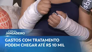 THE ANA CLARA CASE: YOUNG WOMAN NEEDS HELP TO COVER HAND REHABILITATION TREATMENT