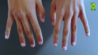 Say Goodbye to Pigmentation | Clear Skin Starts Here | Dr. Batool Ashraf | Masala Digital
