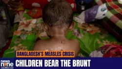 Measles Outbreak In Bangladesh: Over 1,100 Deaths Reported As Gaps In Vaccination Drive  Exposed