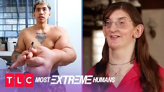 Mark and Rumeysa's Unique Conditions | Most Extreme Humans | TLC