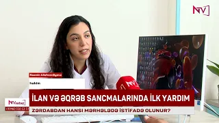 Zərdab nə vaxt və hansı hallarda istifadə olunur?