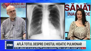 Pulmonary Hydatid Cyst. Health Above All June 30, 2026. Dr. Ovidiu Rus