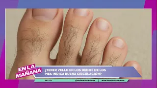 Does Having Hair on Your Toes Indicate Good Circulation? | In The Morning