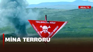 Mina partlayışında xəsarət alan şəxs xəstəxanaya yerləşdirilib