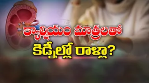 క్యాల్షియం మాత్రలతో కిడ్నీల్లో రాళ్లా? Do Calcium supplement cause stones in Kidneys?| Sukhibhava