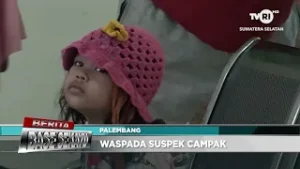 BERITA BASO SEKAYU - WASPADA SUSPEK CAMPAK