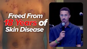 FREED FROM 18 YEARS OF SKIN DISEASE