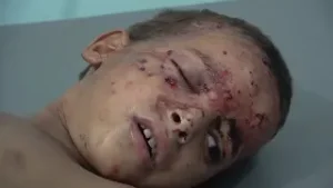 مقذوفات الحوثي تصيب طفلين بالجوف