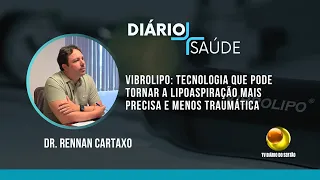Vibroliposuction: technology that can make liposuction more precise and less traumatic