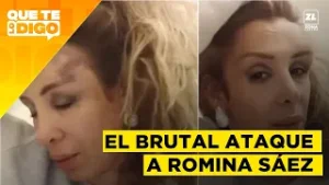 Romina Sáez revela: "ME ROMPIERON UNA BOTELLA EN LA CARA"