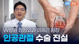 무릎 관절 수술, 무작정 늦추는 게 정답일까?🦵｜내 관절 살리는 절골술부터 최신 로봇 인공관절까지 [TBC클리닉건강365]