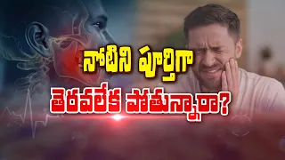 నోటిని పూర్తిగా తెరవలేక పోతున్నారా ? | Are You Unable to Open Your Mouth Fully ? | Sukhibhava