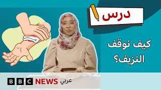 الإسعافات الأولية للنزيف: 5 خطوات لمساعدة شخص ينزف | درس